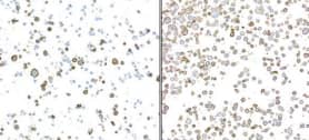 Immunohistochemistry-Paraffin Fc gamma RIIIB/CD16b Antibody (BLR163J)
