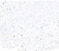 Immunohistochemistry-Paraffin:ASCL1/Mash1 Antibody [NBP3-14738] -ASCL1/MASH1 recombinant monoclonal antibody [BLR164J]. Secondary: HRP-conjugated goat antirabbit IgG (A120-501P). Substrate: DAB.