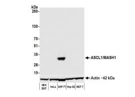 Western Blot: ASCL1/Mash1 Antibody [NBP3-14738] - Whole cell lysate (50 ug) from HEK293T, HeLa, SHP-77, Hep-G2, and MCF-7 cells prepared using NETN lysis buffer. Antibody: Rabbit anti-ASCL1/MASH1 recombinant monoclonal antibody [BLR164J] used at 1:1000. Secondary: HRP-conjugated goat antirabbit IgG. Chemiluminescence with an exposure time of 10 seconds. Lower Panel: Rabbit antiActin recombinant monoclonal antibody [BLR057F]. 