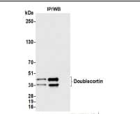 Immunoprecipitation- Doublecortin Antibody (BLR168J)-NBP3-14742-Whole cell lysate (1.0 mg per IP reaction; 20% of IP loaded) from SK-N-BE(2) cells prepared using NETN lysis buffer. Antibodies: Rabbit antiDoublecortin recombinant monoclonal antibody [BLR168J] used for IP at 20 ul/mg lysate. Doublecortin was also immunoprecipitated by a second antibody against a different epitope of Doublecortin (BL-1974A-2B1). For blotting immunoprecipitated Doublecortin was used at 1:1000. Chemiluminescence with an exposure time of 10 seconds.