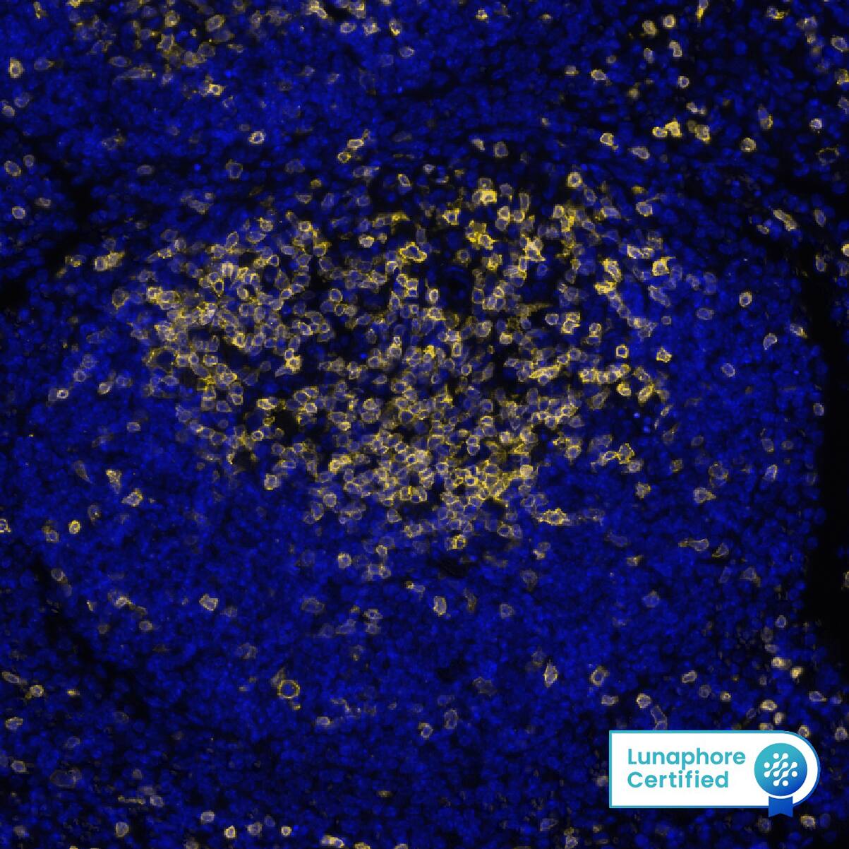 CD3e was detected in immersion fixed paraffin-embedded sections of mouse Spleen using Rabbit Anti-Human/Mouse CD3e, Monoclonal Antibody (Catalog # NBP3-14747) at 1:4000 at 37° Celsius for 4 minutes. Before incubation with the primary antibody, tissue underwent an all-in-one dewaxing and antigen retrieval preprocessing using PreTreatment Module (PT Module) and Dewax and HIER Buffer H (pH 9; Epredia Catalog # TA-999-DHBH). Tissue was stained using the Alexa Fluor™ Plus 555 Goat anti-Rabbit IgG Secondary Antibody at 1:100 at 37 ° Celsius for 2 minutes. (Yellow; Lunaphore Catalog # DR555RB) and counterstained with DAPI (blue; Lunaphore Catalog # DR100).​ Specific staining was localized to the membrane. Protocol available in COMET™ Panel Builder.