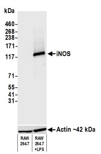 Western Blot;iNOS Antibody (BLR181J)  Whole cell lysate (10 µg) from RAW 264.7 and LPS-treated RAW 264.7 cells prepared using NETN lysis buffer. Antibody: Rabbit anti-iNOS recombinant monoclonal antibody  used at 1:1000. Secondary: HRP-conjugated goat anti-rabbit IgG . Detection: Chemiluminescence with an exposure time of 3 seconds. Lower Panel: Rabbit anti-Actin recombinant monoclonal antibody .