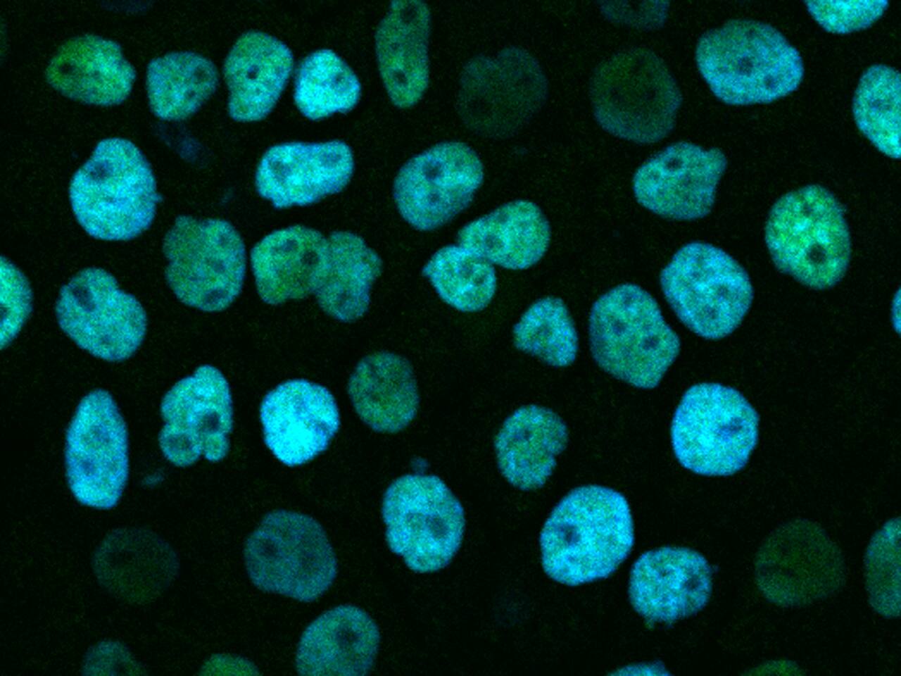 Immunocytochemistry/Immunofluorescence: RBM14 Antibody [NBP3-14796] - Immunofluorescence staining of RBM14 in A431 cells. Cells were fixed with 4% PFA, permeabilzed with 0.3% Triton X-100 in PBS,blocked with 10% serum, and incubated with NBP3-14796 antibody (dilution ratio 1:100) at 4C overnight. Then cells were stained with the Alexa Fluor(R)488-conjugated Goat Anti-rabbit IgG secondary antibody (green) and counterstained with DAPI (blue).Positive staining was localized to Nucleus.