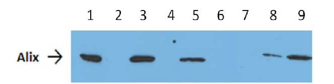 CD9 Immunobeads for Exosome Isolation (Mouse) [NBP3-14799] - Alix expression by western blotting of human plasma exosomes captured on lmmunobeads from 0.5 ml of plasma in comparison with exosomes purified via ultracentrifuge. 1, 3 and 5: lmmunocapture with immunobeads from 1 ml, 0.5 ml and 100 Âµ1 of human plasma respectively. 2, 4, 6: Ultra centrifuged exosomes from plasma after immunobeads capture. 7 lmmunocapture with immunobeads isotype coupled. 8, 9: Ultracentifuged exosome from 0.5 ml and 1 ml of human plasma.