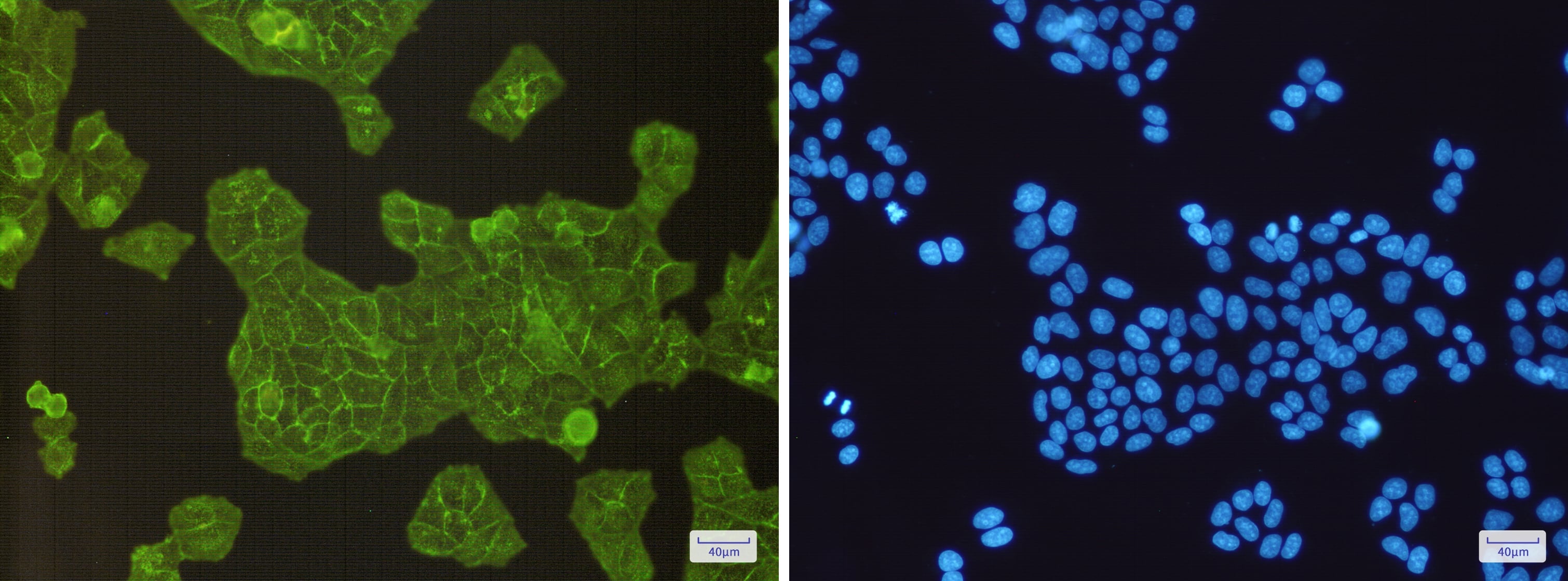 Immunocytochemistry/Immunofluorescence: Alpha Actinin 4 Antibody (S06-3D7) [NBP3-14888] - Immunofluorescence of Alpha Actinin 4 (green) in Hela cells using NBP3-14888 at dilution 1/200, and DAPI (blue)
