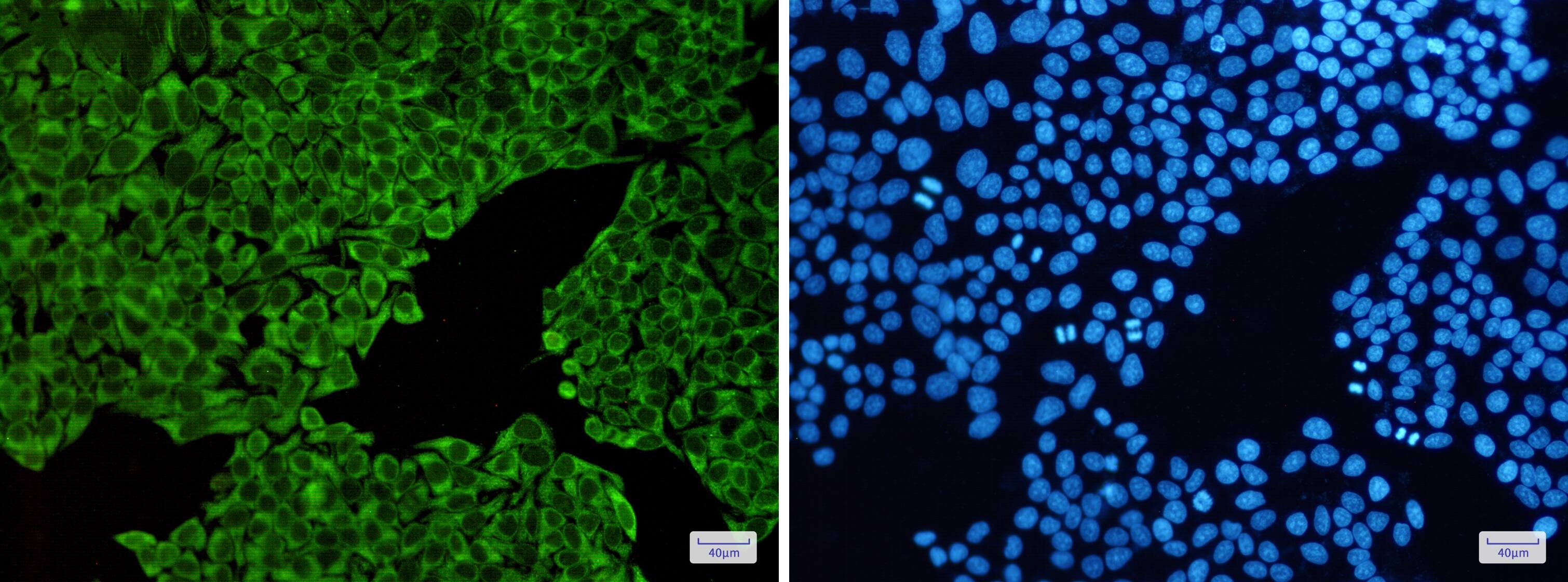 Immunocytochemistry/Immunofluorescence: ENO3 Antibody (S07-5B2) [NBP3-14890] - Immunofluorescence of ENO3 (green) in Hela cells using NBP3-14890 at dilution 1/50, and DAPI (blue)