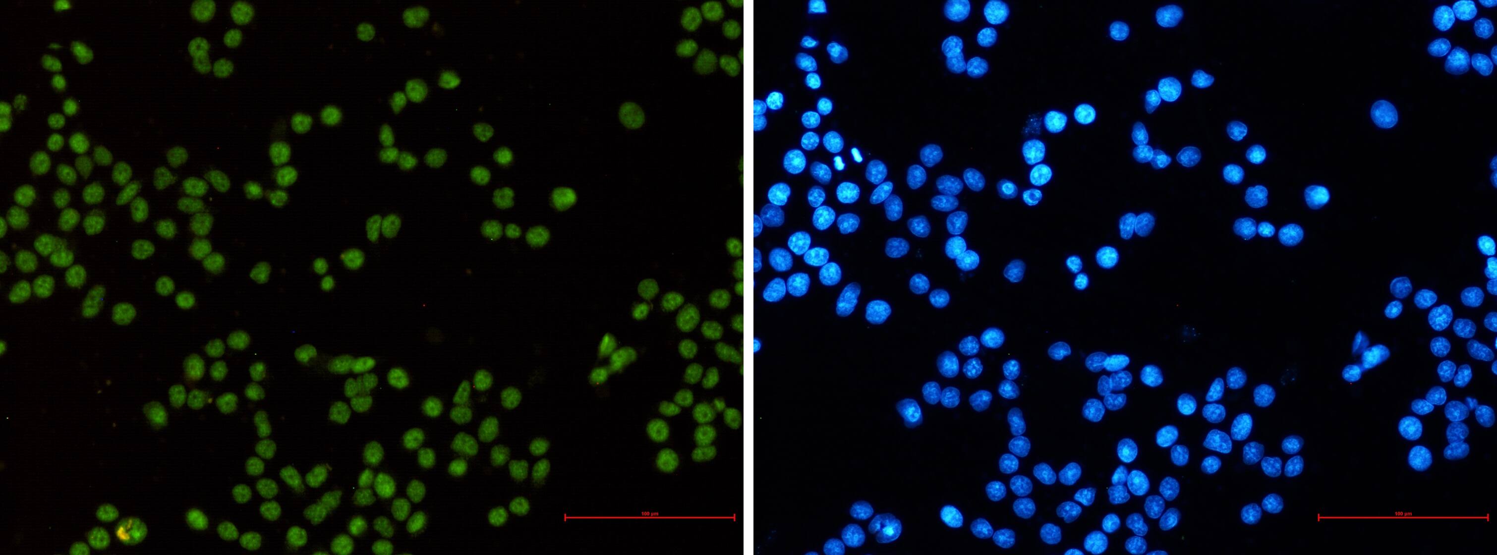 Immunocytochemistry/Immunofluorescence: MLH1 Antibody (S07-5D3) [NBP3-14898] - Immunocytochemistry of MLH1 (green) in hela using NBP3-14898 at dilution 1/50, and DAPI (blue)