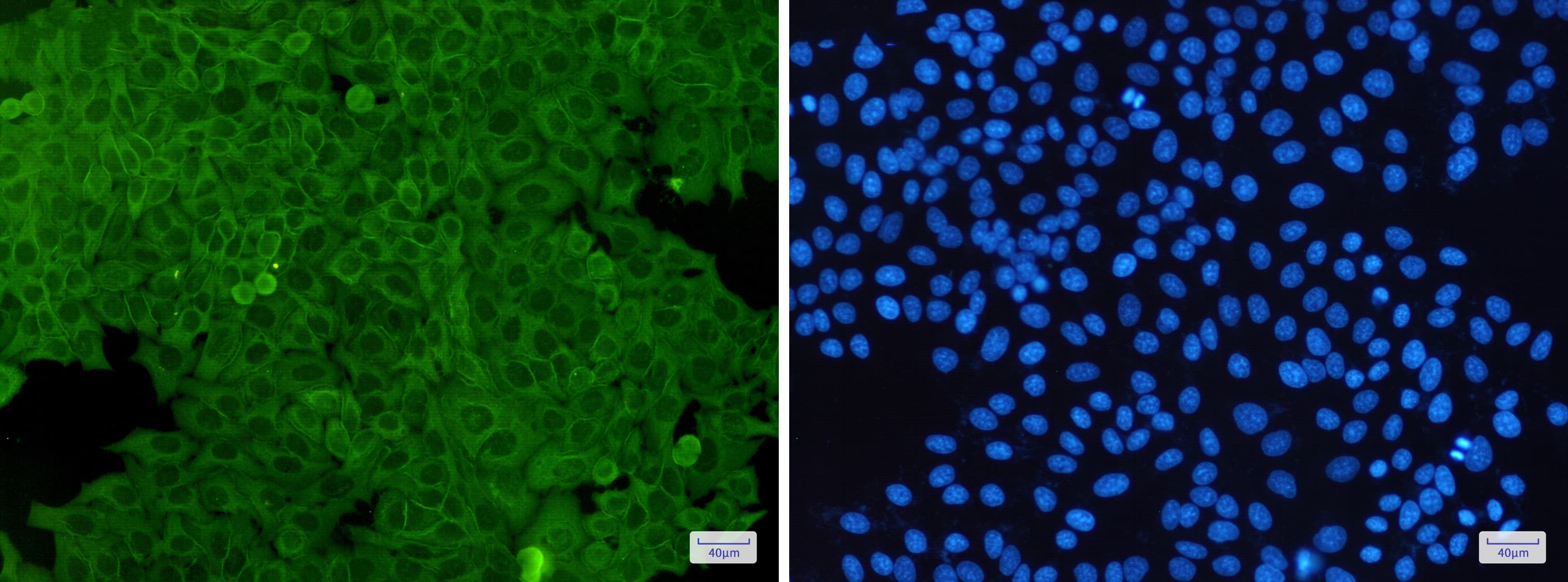 Immunocytochemistry/Immunofluorescence: Annexin A2 Antibody (S09-5C1) [NBP3-14907] - Immunofluorescence of Annexin A2 (green) in Hela cells using NBP3-14907 at dilution 1/50, and DAPI (blue)