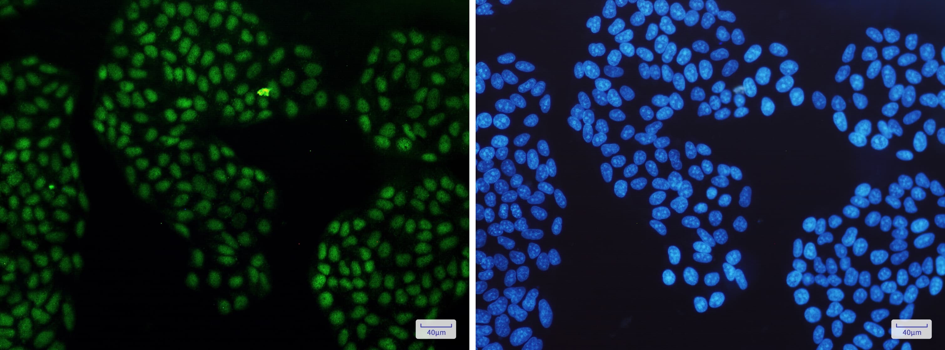 Immunocytochemistry/Immunofluorescence: GR/NR3C1 Antibody (S04-8C8) [NBP3-14938] - Immunofluorescence of GR/NR3C1 (green) in Hela cells using NBP3-14938 at dilution 1/50, and DAPI (blue)