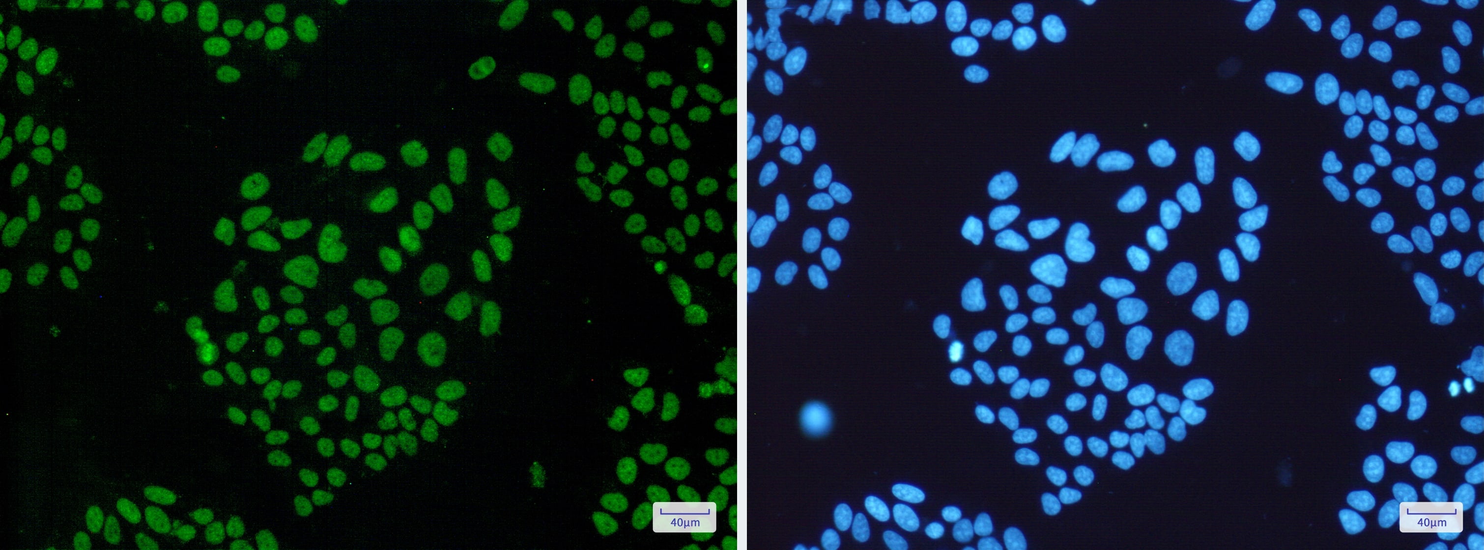 Immunocytochemistry/Immunofluorescence: hHpr1-p84-Thoc1 Antibody (S05-1A8) [NBP3-14940] - Immunofluorescence of hHpr1-p84-Thoc1 (green) in Hela cells using NBP3-14940 at dilution 1/50, and DAPI (blue)