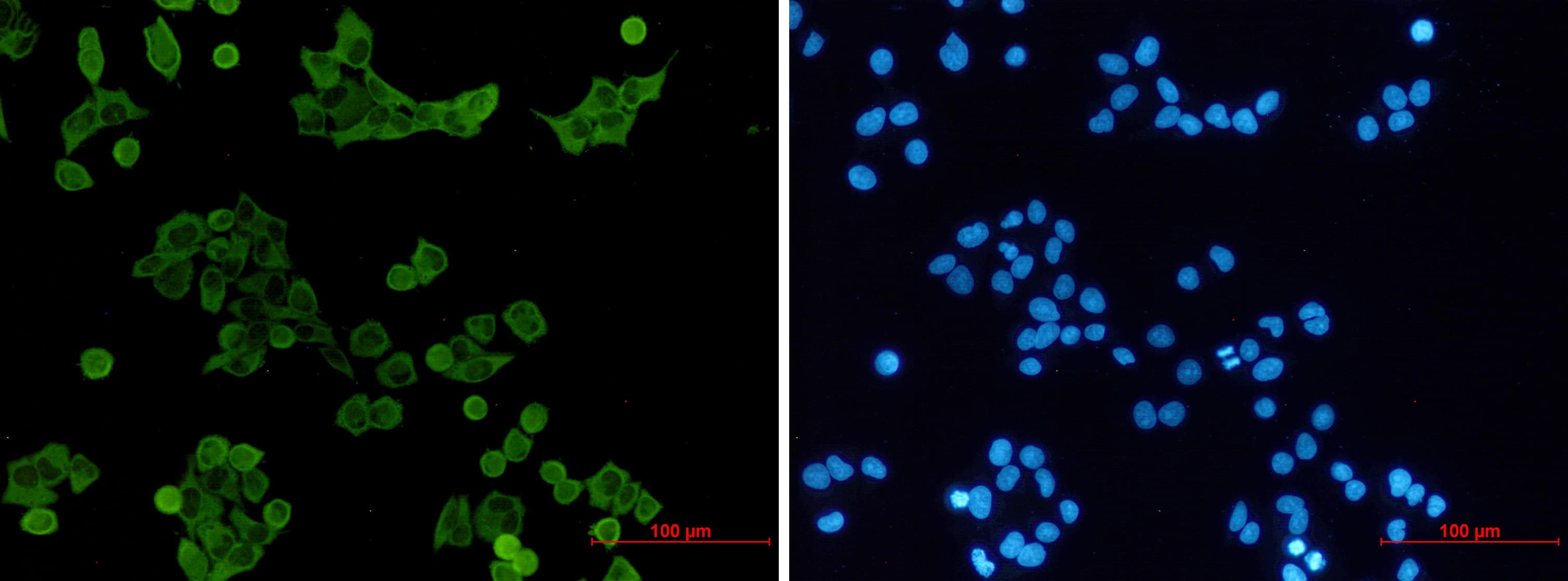 Immunocytochemistry/Immunofluorescence: Hck Antibody (S02-5C1) [NBP3-14957] - Immunocytochemistry of Hck (green) in hela using NBP3-14957 at dilution 1/50, and DAPI (blue)