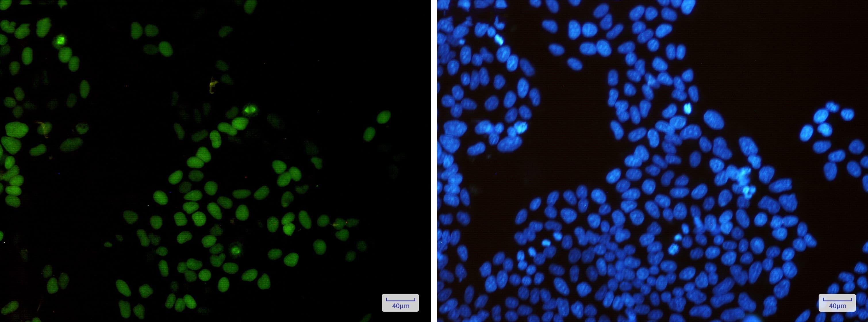 Immunocytochemistry/Immunofluorescence: KIFC1 Antibody (S03-3E4) [NBP3-15052] - Immunofluorescence of KIFC1 (green) in Hela cells using NBP3-15052 at dilution 1/50, and DAPI (blue)
