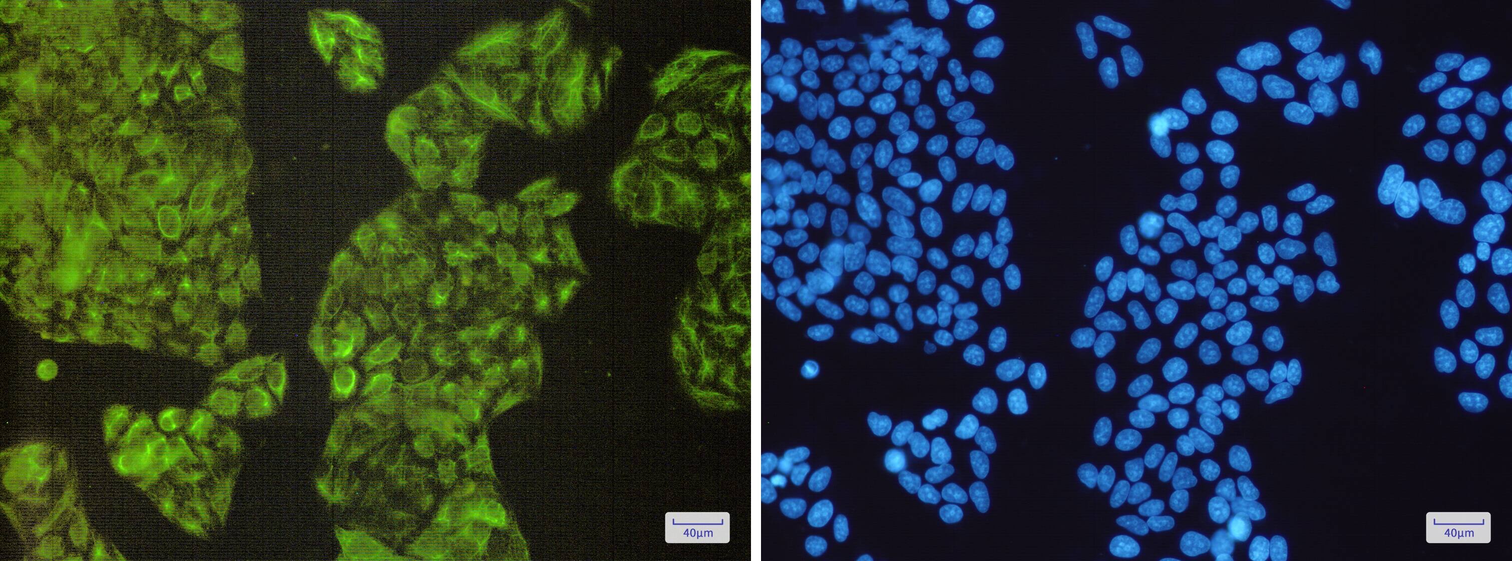 Immunocytochemistry/Immunofluorescence: NCK2 Antibody (S01-3C6) [NBP3-15063] - Immunofluorescence of NCK2 (green) in Hela cells using NBP3-15063 at dilution 1/200, and DAPI (blue)