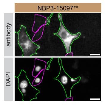 <b>Genetic Strategies Validation. </b>U‑87 MG human glioblastoma/astrocytoma parental cell line WT and Syntaxin-BP1 U-87 MG KO cells were labelled with a green or a far-red fluorescent dye, respectively. Cells were stained with Syntaxin-BP1 Antibody (S05-4B6) (Catalog # NBP3-15097) followed by incubation with an Alexa-fluor 555 conjugated secondary antibody (upper panel). DAPI-only counterstained cells shown on a lower panel. Acquisition of the blue (nucleus-DAPI), green (identification of WT cells), red (antibody staining) and far-red (identification of KO cells) channels was performed. Representative images of the blue and red (grayscale) channels are shown. WT and KO cells are outlined with green and magenta dashed line, respectively. Primary antibody dilution used: 1/500. Image, protocol and testing courtesy of YCharOS Inc. (ycharos.com).