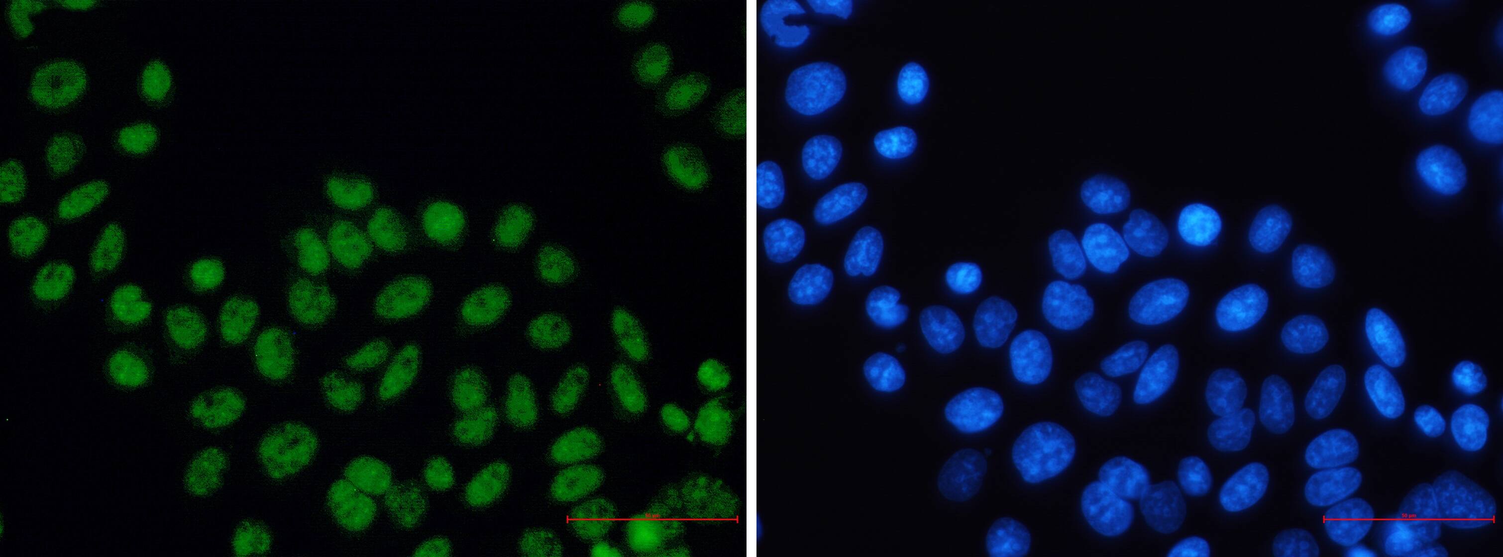 Immunocytochemistry/Immunofluorescence: XPD Antibody (S08-2I3) [NBP3-15112] - Immunocytochemistry of XPD (green) in Hela using NBP3-15112 at dilution 1/50, and DAPI (blue)