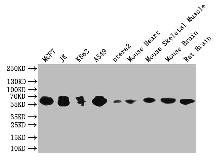 Western Blot: PAK1 Antibody (4F10) [NBP3-15141] - Positive WB detected in: MCF7 whole cell lysate, JK whole cell lysate, K562 whole cell lysate, A549 whole cell lysate, ntera2 whole cell lysate, Mouse Heart tissue lysate, Mouse Skeletal Muscle tissue lysate, Mouse Brain tissue lysate, Rat Brain tissue lysateAll lanes: PAK1 antibody at 1:1000SecondaryGoat polyclonal to rabbit IgG at 1/50000 dilutionPredicted band size: 61 kDaObserved band size: 61 kDa