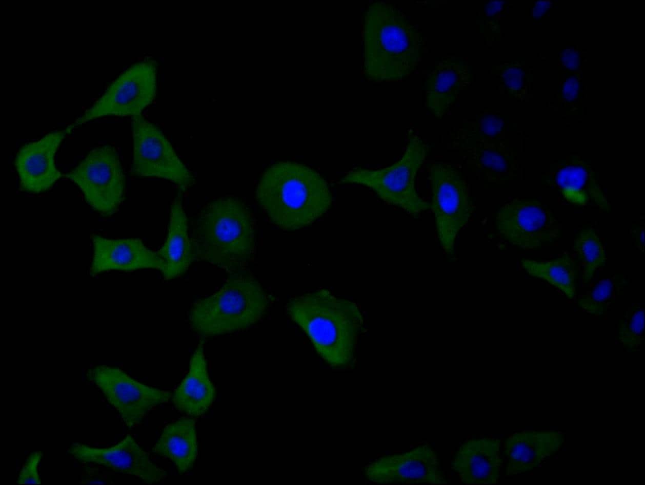 Immunocytochemistry/Immunofluorescence: PAK1 Antibody (4F10) [NBP3-15141] - Staining of Hela cell with NBP3-15141 at 1:30, counter-stained with DAPI. The cells were fixed in 4% formaldehyde and blocked in 10% normal Goat Serum. The cells were then incubated with the antibody overnight at 4C. The secondary antibody was Alexa Fluor 488-congugated AffiniPure Goat Anti-Rabbit IgG (H+L).