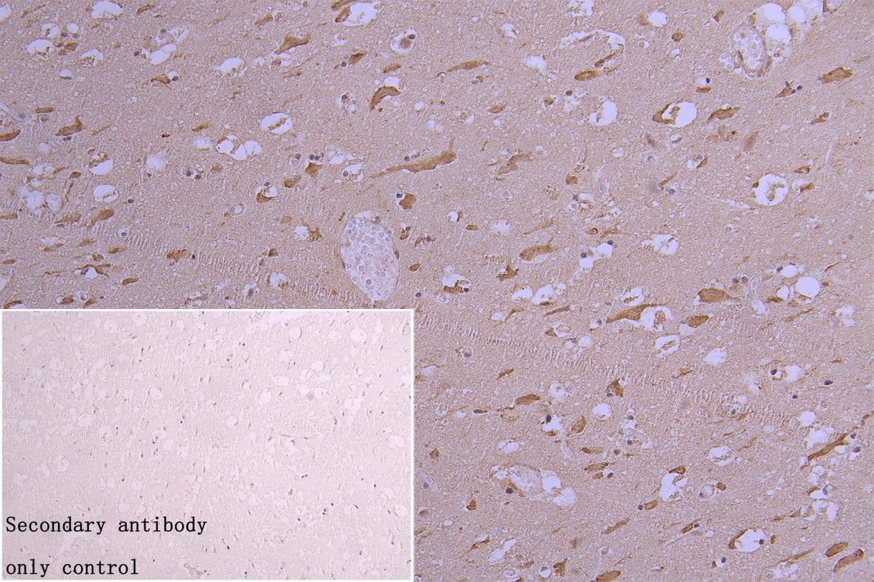 Immunohistochemistry: Rabbit Muscarinic Acetylcholine Receptor M3/CHRM3 mAb (2D4) [NBP3-15165] - Muscarinic Acetylcholine Receptor M3/CHRM3 Antibody diluted at 1:300 and staining in paraffin-embedded human brain tissue. After dewaxing and hydration, antigen retrieval was mediated by high pressure in a citrate buffer (pH 6.0). Section was blocked with 10% normal goat serum 30min at RT. Then primary antibody (1% BSA) was incubated at 4°C overnight. The primary is detected by a Goat anti-rabbit polymer IgG labeled by HRP and visualized using 0.05% DAB. Secondary antibody only control: uses 1% BSA instead of primary antibody.