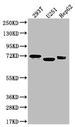 Western Blot: SLC6A4/5-HTTLPR/Serotonin transporter Antibody (9G3) [NBP3-15198] - Positive WB detected in: U-87 whole cell lysate, 293T whole cell lysate, U-251 whole cell lysate, HepG2 whole cell lysateAll lanes: Serotonin transporter antibody at 1:1000SecondaryGoat polyclonal to rabbit IgG at 1/50000 dilutionPredicted band size: 71, 75 kDaObserved band size: 55 kDa