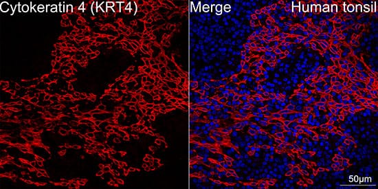 Immunocytochemistry/ Immunofluorescence: Cytokeratin 4 Antibody (6H9R6) [Cytokeratin 4] - Confocal imaging of human tonsil tissue using Cytokeratin 4 Rabbit mAb . DAPI was used for nuclear staining (blue). Objective: 40x.Perform high pressure antigen retrieval with 10 mM citrate buffer (pH 6.0) before commencing with IF staining protocol.