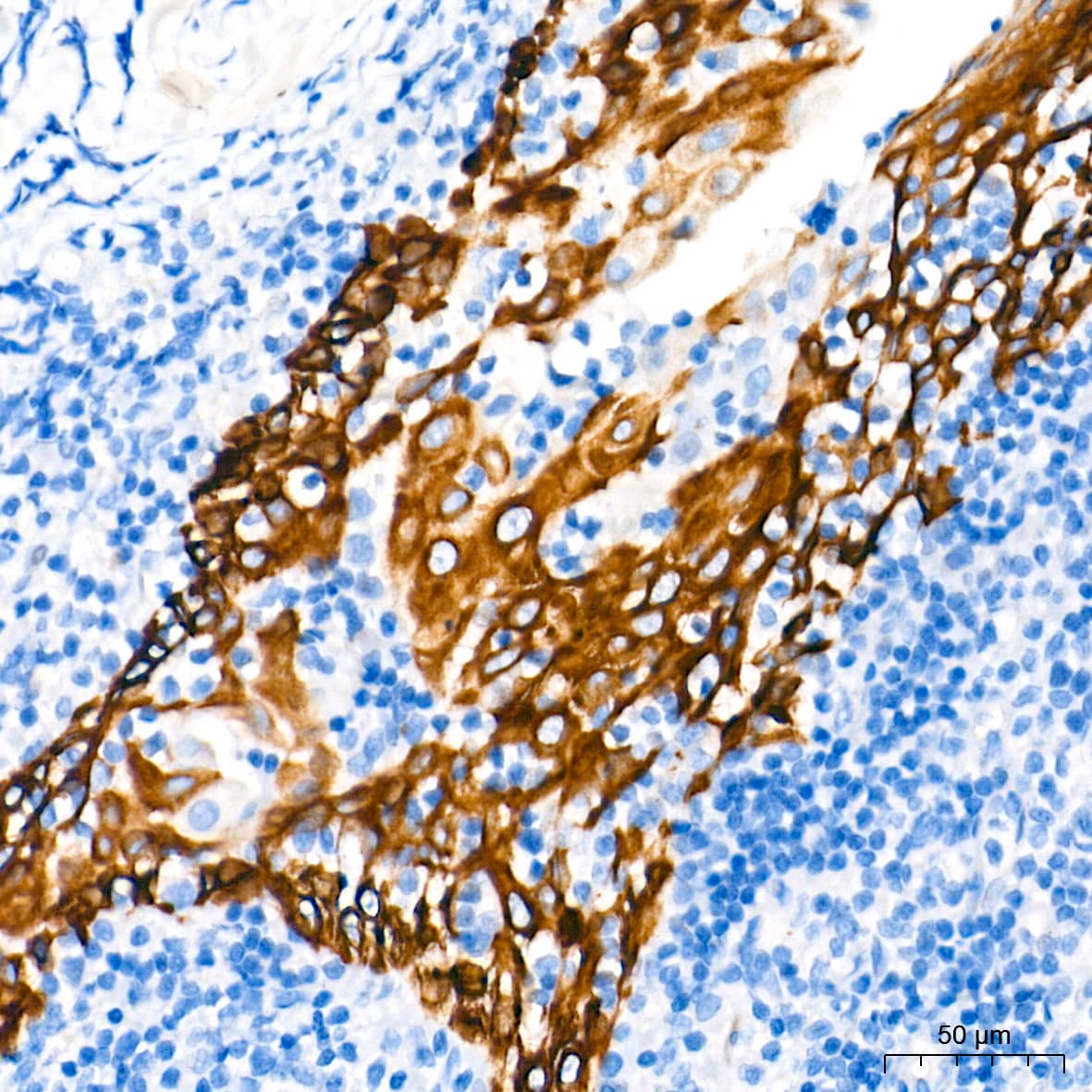 Immunohistochemistry: Cytokeratin 4 Antibody (6H9R6) [Cytokeratin 4] - Immunohistochemistry analysis of paraffin-embedded human tonsil tissue using Cytokeratin 4 Rabbit mAb  at a dilution of 1:500 (40x lens). High pressure antigen retrieval performed with 0.01M Tris-EDTA Buffer(pH 9.0) prior to IHC staining.