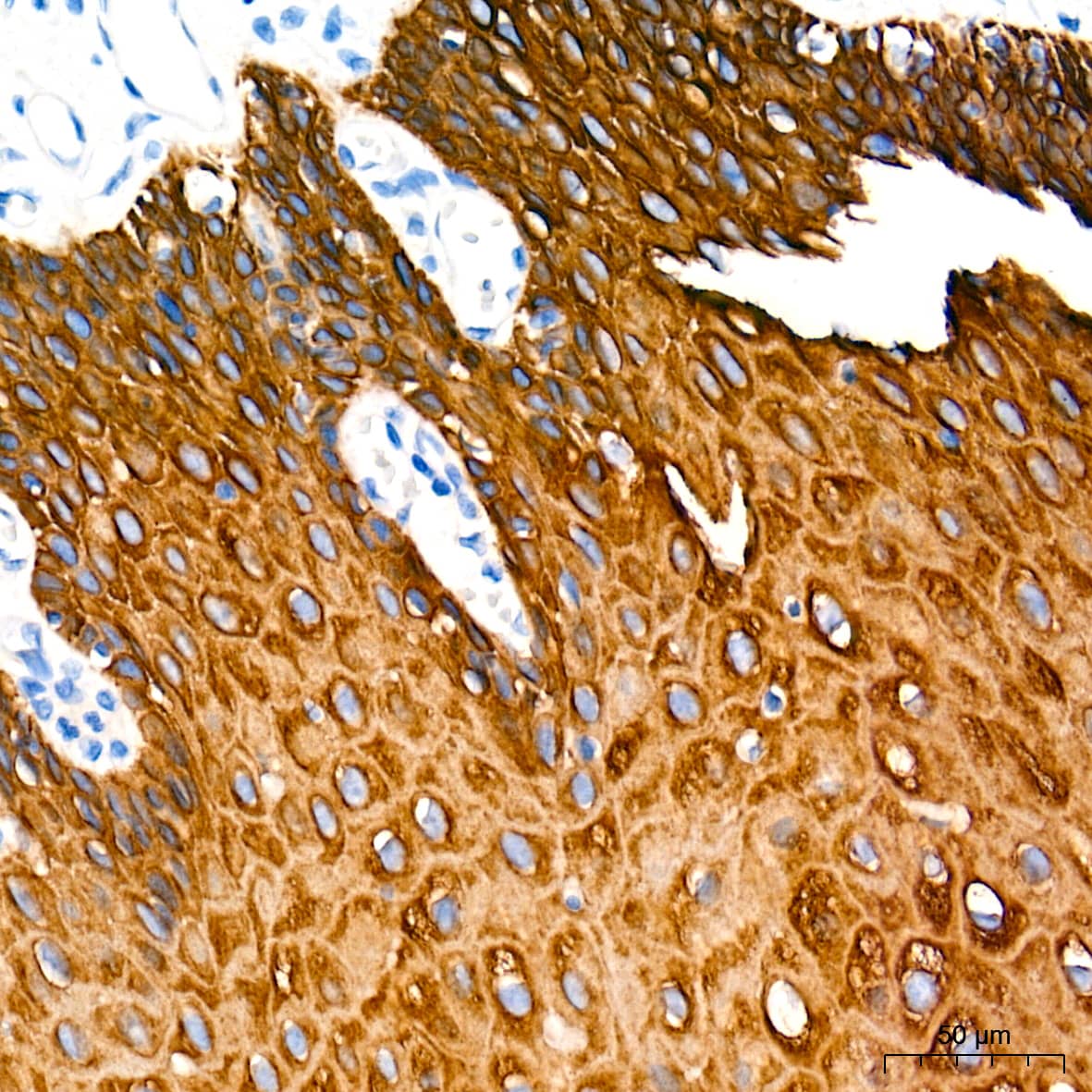 Immunohistochemistry: Cytokeratin 4 Antibody (6H9R6) [Cytokeratin 4] - Immunohistochemistry analysis of paraffin-embedded human esophagus tissue using Cytokeratin 4 Rabbit mAb  at a dilution of 1:500 (40x lens). High pressure antigen retrieval performed with 0.01M Tris-EDTA Buffer(pH 9.0) prior to IHC staining.