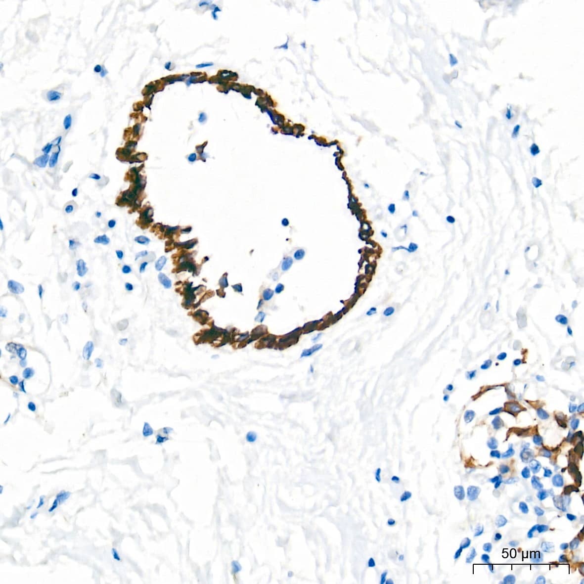 Immunohistochemistry: Cytokeratin 4 Antibody (6H9R6) [Cytokeratin 4] - Immunohistochemistry analysis of paraffin-embedded human breast tissue using Cytokeratin 4 Rabbit mAb  at a dilution of 1:500 (40x lens). High pressure antigen retrieval performed with 0.01M Tris-EDTA Buffer(pH 9.0) prior to IHC staining.