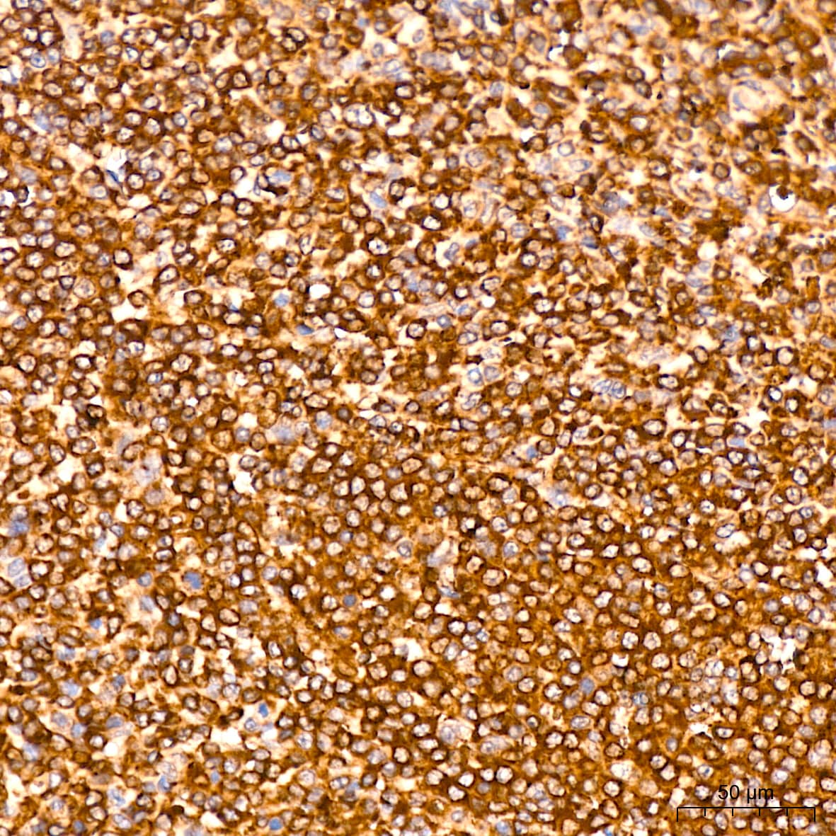 Immunohistochemistry: MMP-14/MT1-MMP Antibody (6T7L3) [MMP-14/MT1-MMP] - Immunohistochemistry analysis of paraffin-embedded Human spleen tissue using MMP-14/MT1-MMP Rabbit mAb  at a dilution of 1:200 (40x lens). High pressure antigen retrieval performed with 0.01M Citrate Bufferr (pH 6.0) prior to IHC staining.