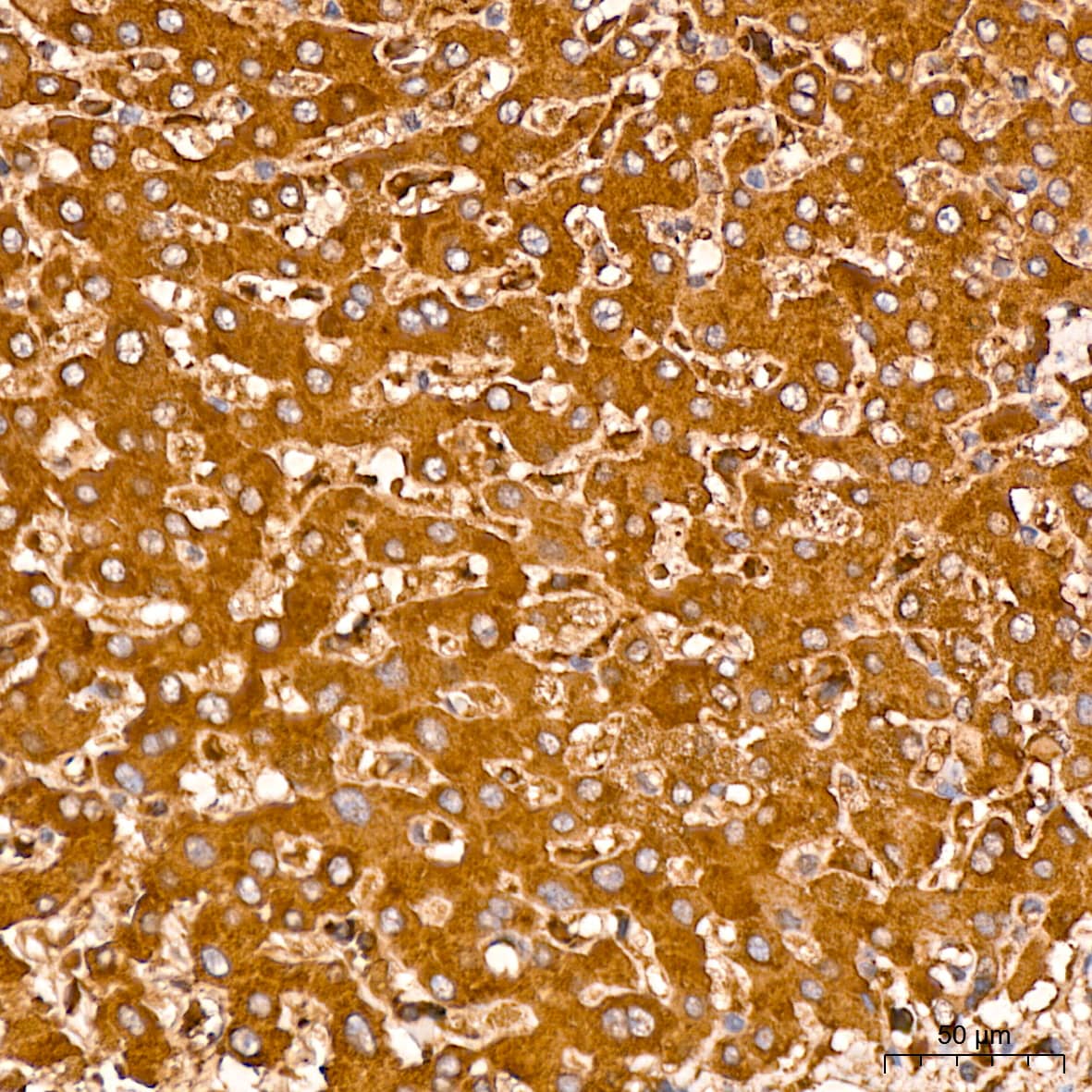 Immunohistochemistry: MMP-14/MT1-MMP Antibody (6T7L3) [MMP-14/MT1-MMP] - Immunohistochemistry analysis of paraffin-embedded Human liver tissue using MMP-14/MT1-MMP Rabbit mAb  at a dilution of 1:200 (40x lens). High pressure antigen retrieval performed with 0.01M Citrate Bufferr (pH 6.0) prior to IHC staining.