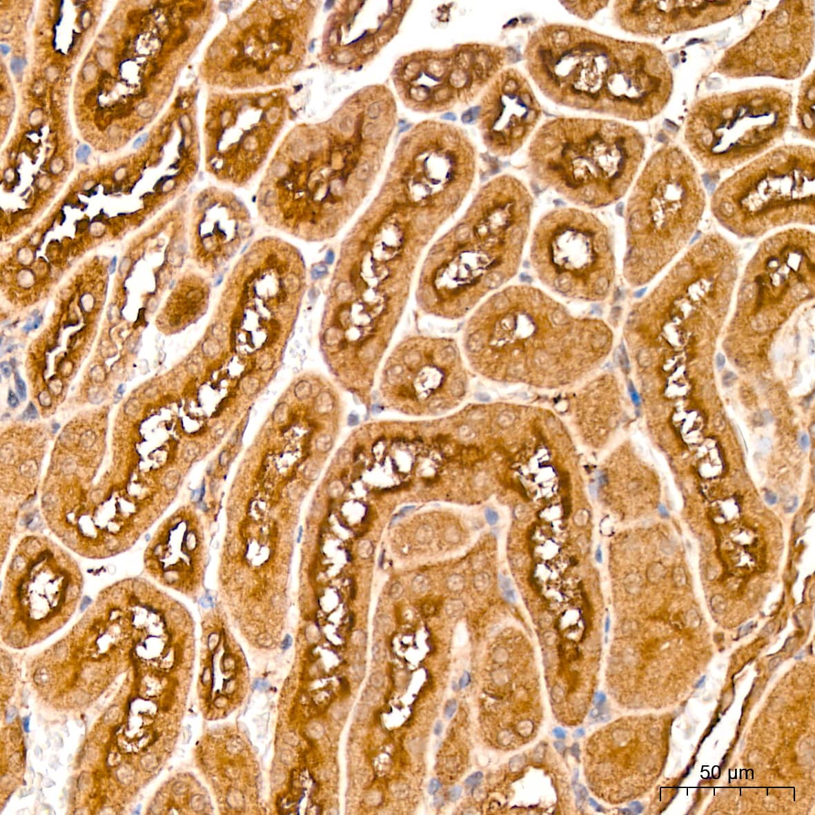 Immunohistochemistry: MMP-14/MT1-MMP Antibody (6T7L3) [MMP-14/MT1-MMP] - Immunohistochemistry analysis of paraffin-embedded Mouse kidney tissue using MMP-14/MT1-MMP Rabbit mAb  at a dilution of 1:200 (40x lens). High pressure antigen retrieval performed with 0.01M Citrate Bufferr (pH 6.0) prior to IHC staining.