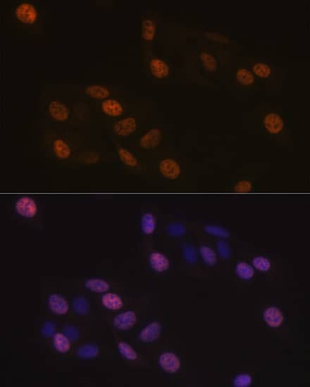 Immunocytochemistry/ Immunofluorescence: KIFC1 Antibody (10M10J4) [KIFC1] - Immunofluorescence analysis of U-2 OS cells using KIFC1 Rabbit mAb  at dilution of 1:100 (40x lens). Secondary antibody: Cy3 Goat Anti-Rabbit IgG (H+L)  at 1:500 dilution. Blue: DAPI for nuclear staining.