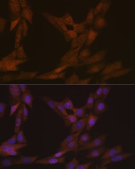 Immunocytochemistry/ Immunofluorescence: KIFC1 Antibody (10M10J4) [KIFC1] - Immunofluorescence analysis of NIH-3T3 cells using KIFC1 Rabbit mAb  at dilution of 1:100 (40x lens). Secondary antibody: Cy3 Goat Anti-Rabbit IgG (H+L)  at 1:500 dilution. Blue: DAPI for nuclear staining.