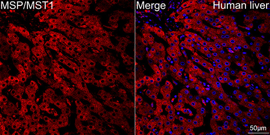 Immunocytochemistry/ Immunofluorescence: MSP/MST1 Antibody (5R7X2) [MSP/MST1] - Confocal imaging of paraffin-embedded Human liver tissue using MSP/MST1 Rabbit mAb  followed by a further incubation with Cy3 Goat Anti-Rabbit IgG (H+L)  . DAPI was used for nuclear staining (Blue). Objective: 40x. Perform high pressure antigen retrieval with 0.01 M citrate buffer (pH 6.0) prior to IF staining.