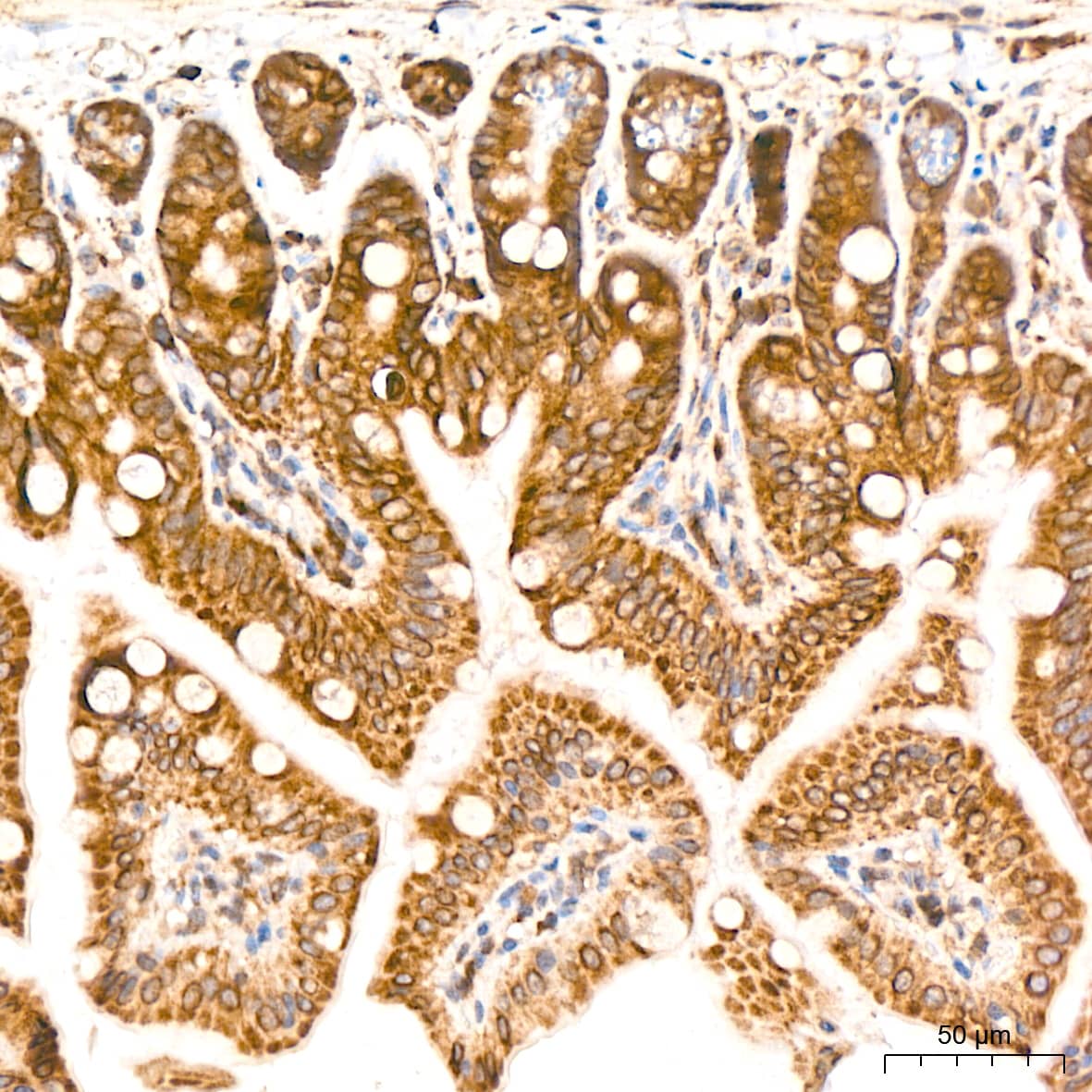 Immunohistochemistry: MSP/MST1 Antibody (5R7X2) [NBP3-15250] - Immunohistochemistry analysis of MSP/MST1 in paraffin-embedded mouse intestin tissue using MSP/MST1 Rabbit mAb  at a dilution of 1:200 (40x lens).High pressure antigen retrieval was performed with 0.01 M citrate buffer (pH 6.0) prior to IHC staining.