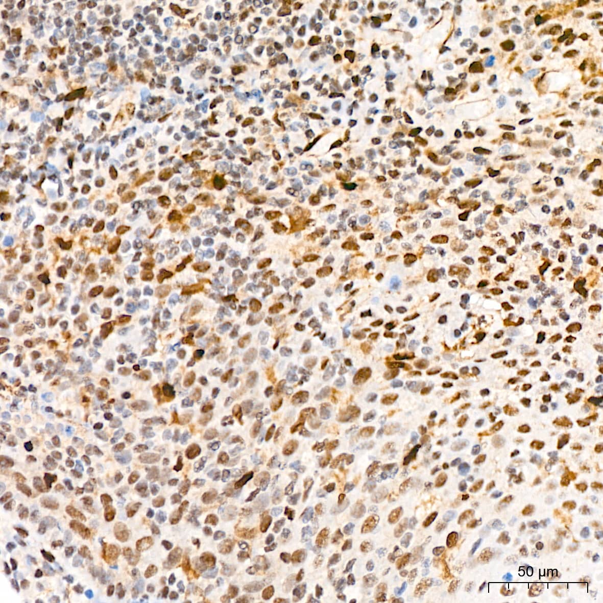 Immunohistochemistry: QKI/Quaking Antibody (1D1N6) [NBP3-15255] - Immunohistochemistry analysis of QKI/Quaking in paraffin-embedded human tonsil tissue using QKI/Quaking Rabbit mAb  at a dilution of 1:200 (40x lens).High pressure antigen retrieval was performed with 0.01 M citrate buffer (pH 6.0) prior to IHC staining.