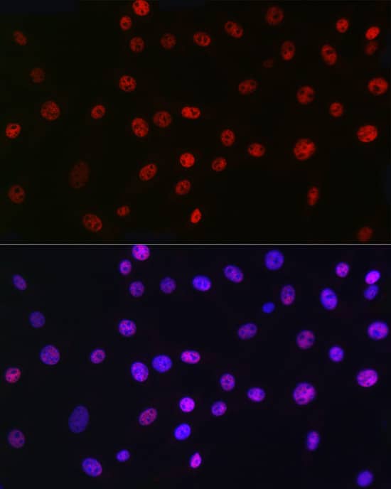 Immunocytochemistry/ Immunofluorescence: QKI/Quaking Antibody (1D1N6) [NBP3-15255] - Immunofluorescence analysis of NIH/3T3 cells using QKI/Quaking Rabbit mAb  at dilution of 1:100 (40x lens). Secondary antibody: Cy3 Goat Anti-Rabbit IgG (H+L)  at 1:500 dilution. Blue: DAPI for nuclear staining.