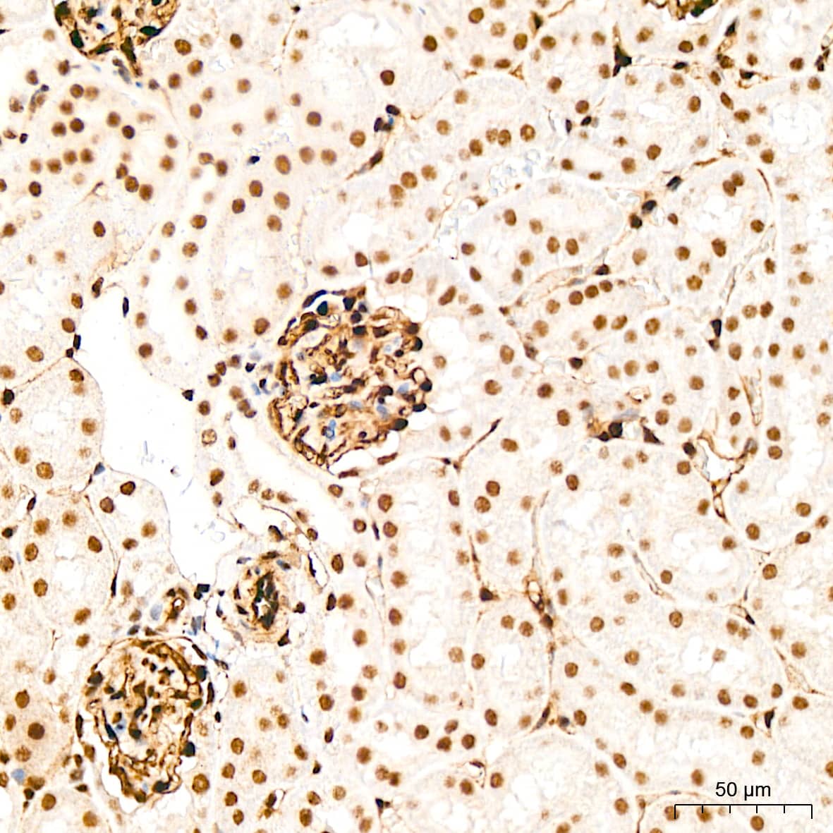 Immunohistochemistry QKI/Quaking Antibody (1D1N6)