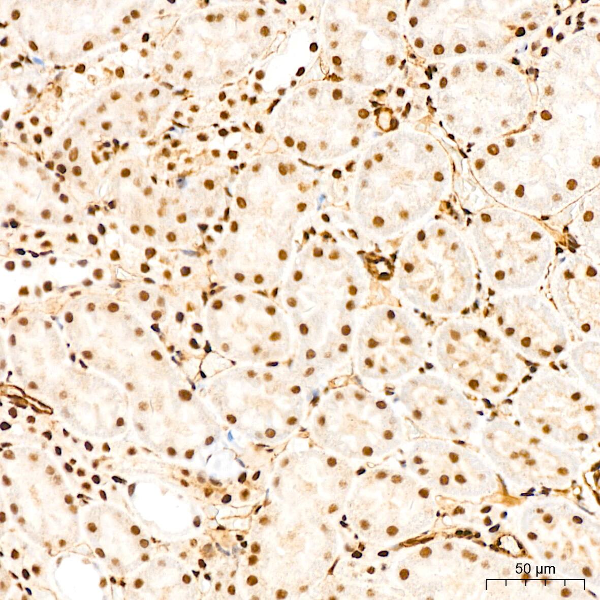 Immunohistochemistry: QKI/Quaking Antibody (1D1N6) [NBP3-15255] - Immunohistochemistry analysis of QKI/Quaking in paraffin-embedded rat kidney tissue using QKI/Quaking Rabbit mAb  at a dilution of 1:200 (40x lens).High pressure antigen retrieval was performed with 0.01 M citrate buffer (pH 6.0) prior to IHC staining.