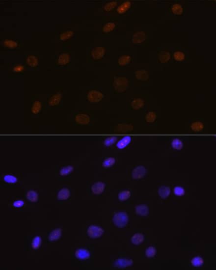 Immunocytochemistry/ Immunofluorescence: DEK Antibody (2C2V8) [DEK] - Immunofluorescence analysis of C6 cells using DEK Rabbit mAb  at dilution of 1:100 (40x lens). Secondary antibody: Cy3 Goat Anti-Rabbit IgG (H+L)  at 1:500 dilution. Blue: DAPI for nuclear staining.