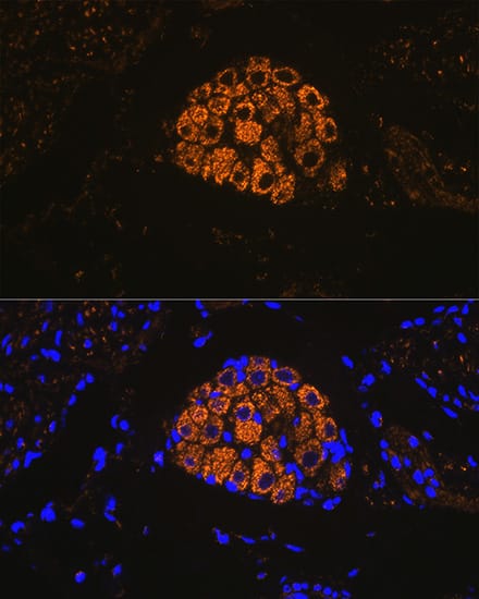 <b>Genetic Strategies Validation. </b>Immunocytochemistry/ Immunofluorescence: Cytokeratin 13 Antibody (5M6B10) [Cytokeratin 13] - Immunofluorescence analysis of paraffin-embedded mouse bladder using Cytokeratin 13 (KRT13) Rabbit mAb  at dilution of 1:100 (40x lens). Secondary antibody: Cy3-conjugated Goat anti-Rabbit IgG (H+L)  at 1:500 dilution. Blue: DAPI for nuclear staining.