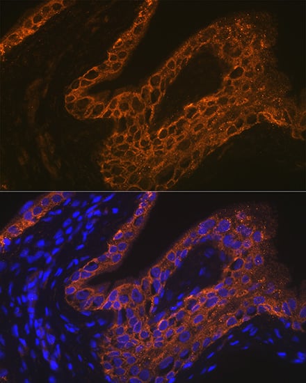 <b>Genetic Strategies Validation. </b>Immunocytochemistry/ Immunofluorescence: Cytokeratin 13 Antibody (5M6B10) [Cytokeratin 13] - Immunofluorescence analysis of paraffin-embedded rat bladder using Cytokeratin 13 (KRT13) Rabbit mAb  at dilution of 1:100 (40x lens). Secondary antibody: Cy3-conjugated Goat anti-Rabbit IgG (H+L)  at 1:500 dilution. Blue: DAPI for nuclear staining.