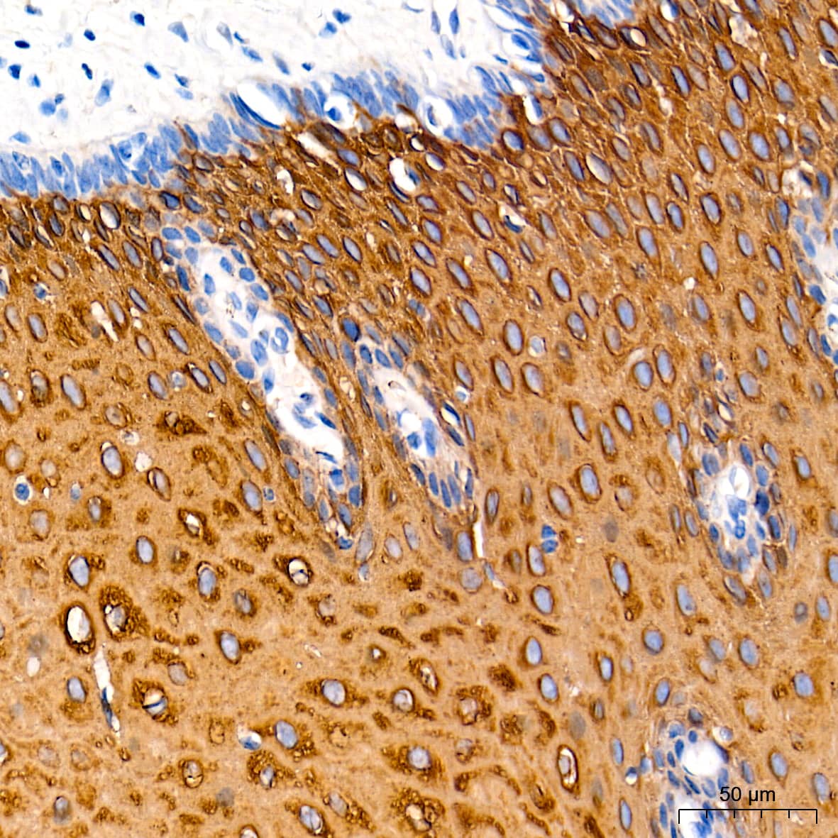 Immunohistochemistry: Cytokeratin 13 Antibody (5M6B10) [Cytokeratin 13] - Immunohistochemistry analysis of paraffin-embedded Human esophagus tissue using Cytokeratin 13 Rabbit mAb  at a dilution of 1:1000 (40x lens). High pressure antigen retrieval performed with 0.01M Tris-EDTA Buffer (pH 9.0) prior to IHC staining.