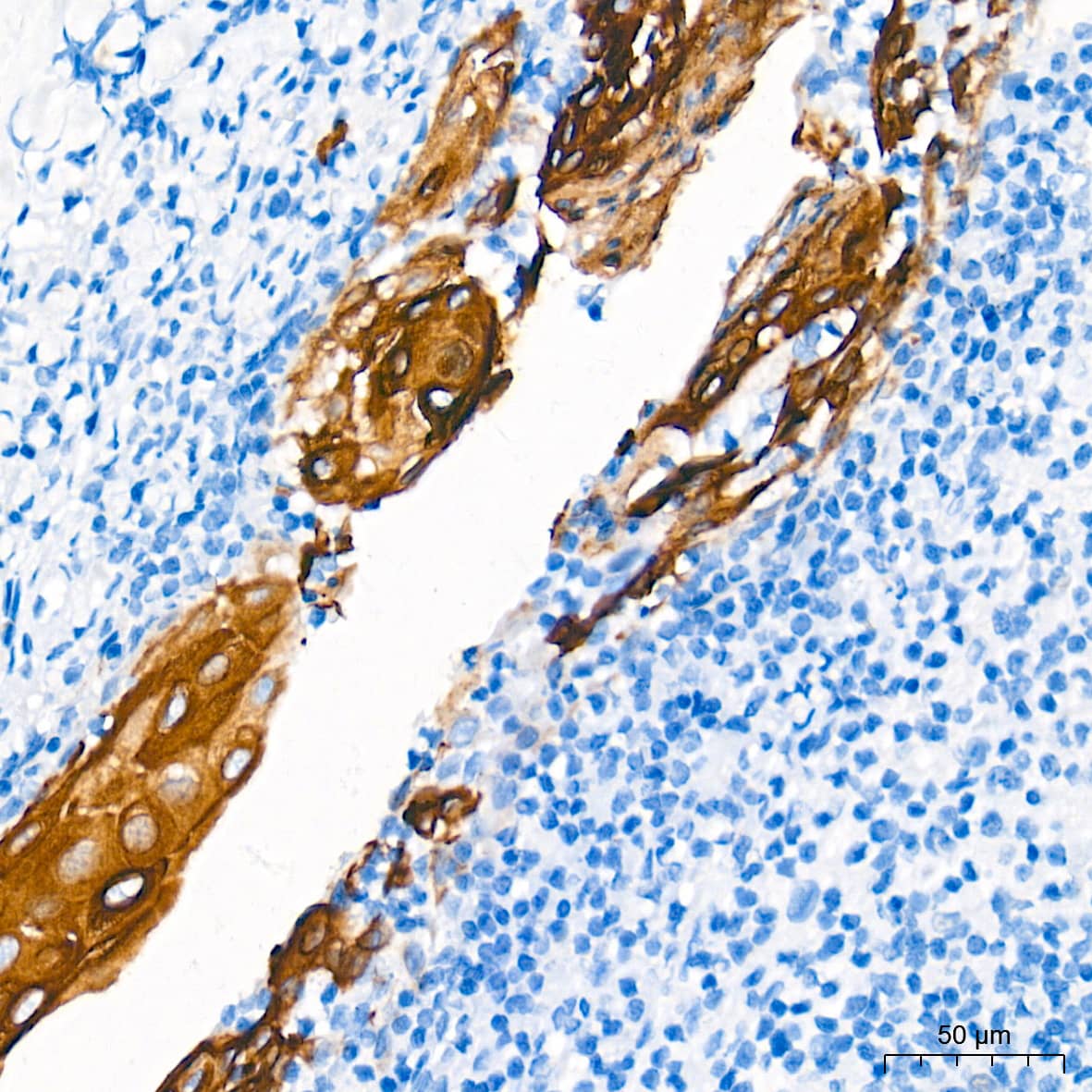 Immunohistochemistry: Cytokeratin 13 Antibody (5M6B10) [Cytokeratin 13] - Immunohistochemistry analysis of paraffin-embedded Human tonsil tissue using Cytokeratin 13 Rabbit mAb  at a dilution of 1:1000 (40x lens). High pressure antigen retrieval performed with 0.01M Tris-EDTA Buffer (pH 9.0) prior to IHC staining.