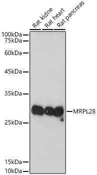 Western Blot: MRPL28 Antibody (3B9F2) [MRPL28] - Western blot analysis of various lysates using MRPL28 Rabbit mAb  at 1:1000 dilution.Secondary antibody: HRP-conjugated Goat anti-Rabbit IgG (H+L)  at 1:10000 dilution.Lysates/proteins: 25ug per lane.Blocking buffer: 3% nonfat dry milk in TBST.Detection: ECL Basic Kit .Exposure time: 10s.