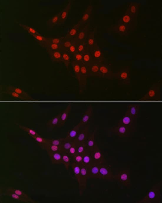 Immunocytochemistry/ Immunofluorescence: CTBP2 Antibody (1R1U6) [CTBP2] - Immunofluorescence analysis of PC-12 cells using CTBP2 Rabbit mAb  at dilution of 1:100 (40x lens). Secondary antibody: Cy3 Goat Anti-Rabbit IgG (H+L)  at 1:500 dilution. Blue: DAPI for nuclear staining.