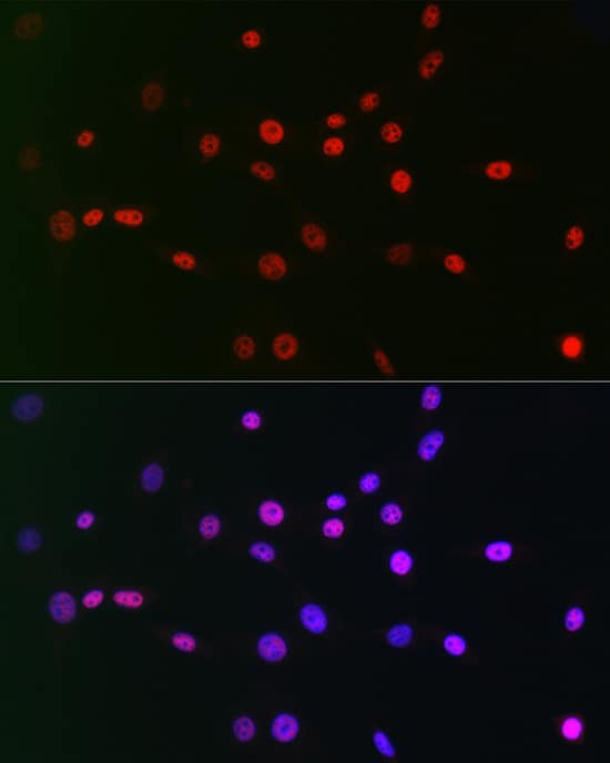 Immunocytochemistry/ Immunofluorescence: CTBP2 Antibody (1R1U6) [CTBP2] - Immunofluorescence analysis of NIH/3T3 cells using CTBP2 Rabbit mAb  at dilution of 1:100 (40x lens). Secondary antibody: Cy3 Goat Anti-Rabbit IgG (H+L)  at 1:500 dilution. Blue: DAPI for nuclear staining.