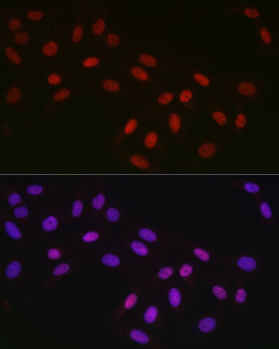 Immunocytochemistry/ Immunofluorescence: CTBP2 Antibody (1R1U6) [CTBP2] - Immunofluorescence analysis of U2OS cells using CTBP2 Rabbit mAb  at dilution of 1:100 (40x lens). Secondary antibody: Cy3 Goat Anti-Rabbit IgG (H+L)  at 1:500 dilution. Blue: DAPI for nuclear staining.