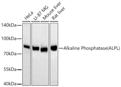 Western Blot: Alkaline Phosphatase/ALPL Antibody (10B1M5) [Alkaline Phosphatase/ALPL] - Western blot analysis of various lysates using Alkaline Phosphatase/ALPL Rabbit mAb  at 1:5000 dilution incubated overnight at 4C.Secondary antibody: HRP-conjugated Goat anti-Rabbit IgG (H+L)  at 1:10000 dilution.Lysates/proteins: 25 ug per lane.Blocking buffer: 3% nonfat dry milk in TBST.Detection: ECL Basic Kit .Exposure time: 10s.