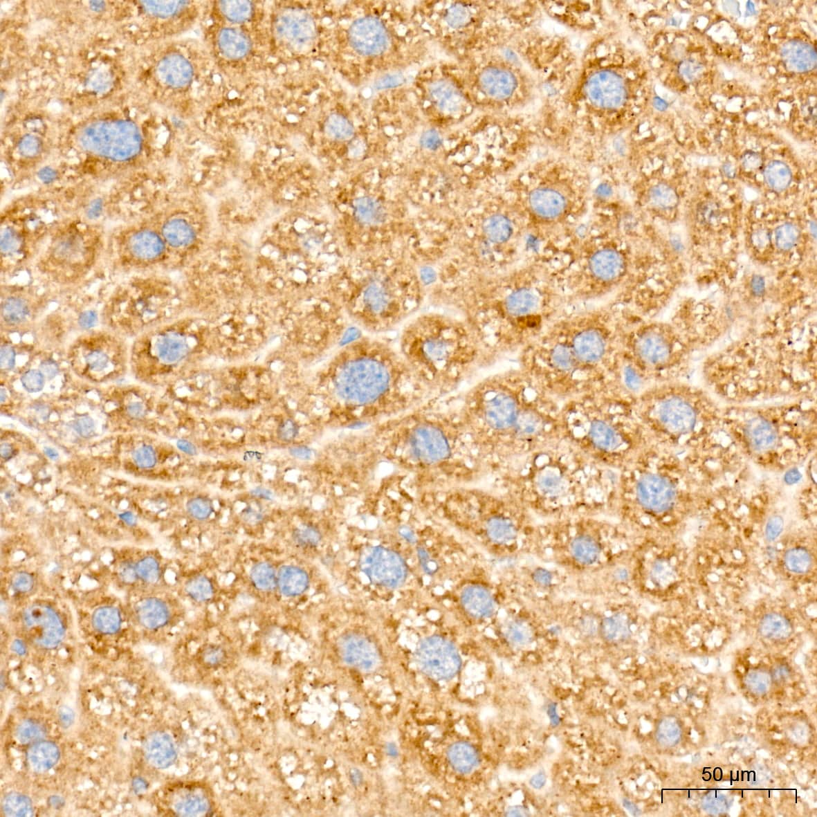 Immunohistochemistry: Alkaline Phosphatase/ALPL Antibody (10B1M5) [Alkaline Phosphatase/ALPL] - Immunohistochemistry analysis of paraffin-embedded Mouse liver tissue using Alkaline Phosphatase/ALPL Rabbit mAb  at a dilution of 1:1000 (40x lens). High pressure antigen retrieval performed with 0.01M Tris-EDTA Buffer (pH 9.0) prior to IHC staining.