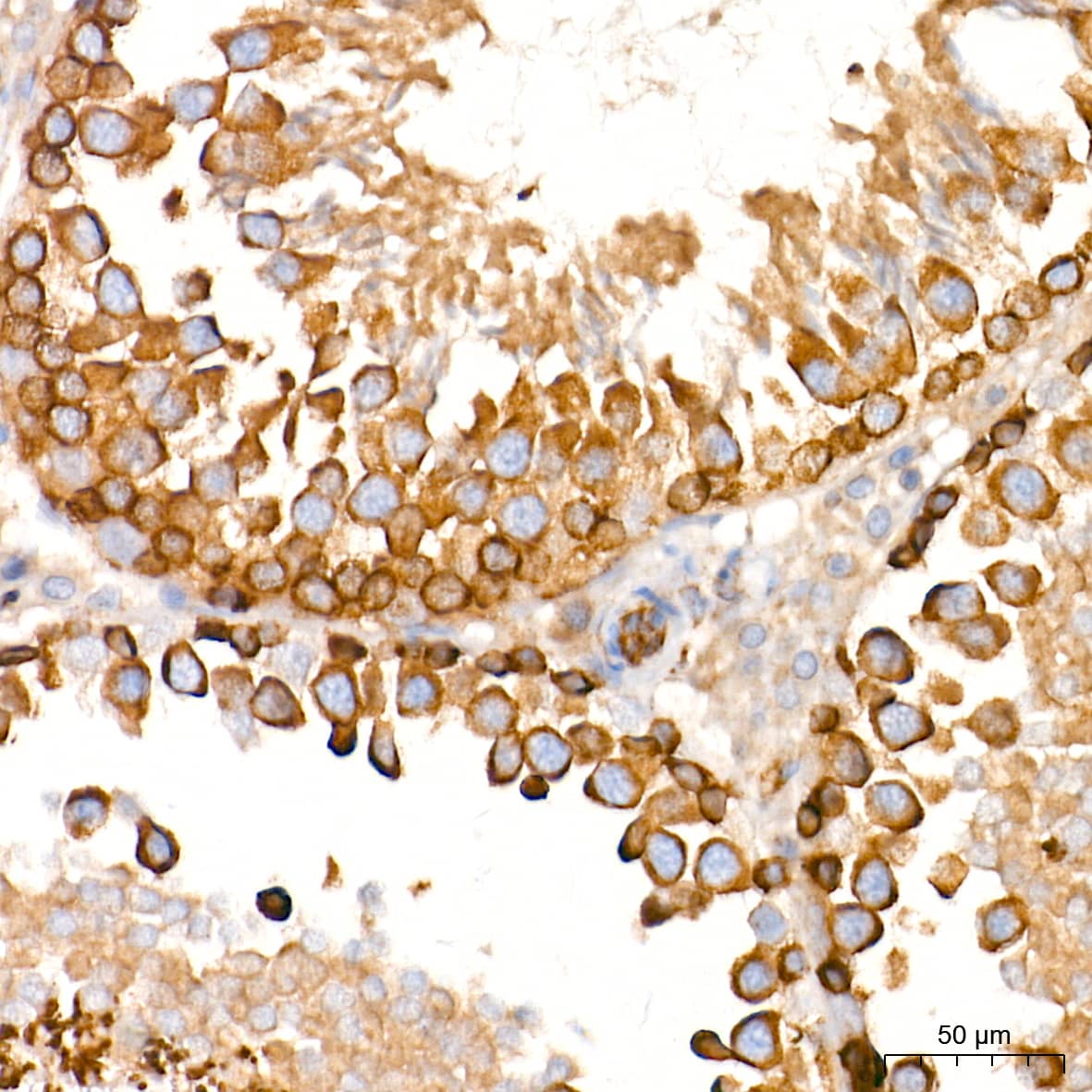 Immunohistochemistry: Alkaline Phosphatase/ALPL Antibody (10B1M5) [Alkaline Phosphatase/ALPL] - Immunohistochemistry analysis of paraffin-embedded Mouse testis tissue using Alkaline Phosphatase/ALPL Rabbit mAb  at a dilution of 1:1000 (40x lens). High pressure antigen retrieval performed with 0.01M Tris-EDTA Buffer (pH 9.0) prior to IHC staining.